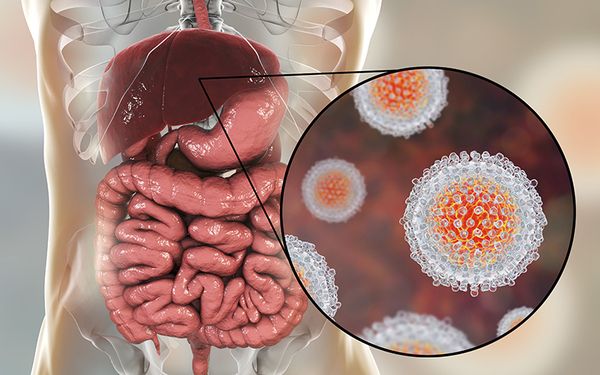 Bệnh có thể gây ra nhiều biến chứng nguy hiểm đến sức khỏe