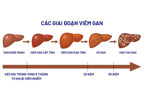 5 giai đoạn phát triển của bệnh